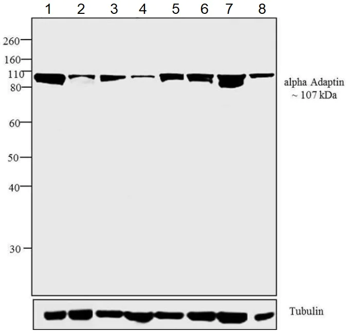 Western blot - Anti-alpha Adaptin antibody [AC1-M11] (AB2807)