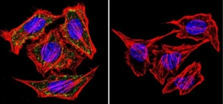 Immunocytochemistry/ Immunofluorescence - Anti-alpha Adaptin antibody [AP6] (AB2730)