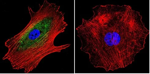 Immunocytochemistry/ Immunofluorescence - Anti-alpha Adaptin antibody [AP6] (AB2730)