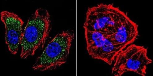 Immunocytochemistry/ Immunofluorescence - Anti-alpha Adaptin antibody [AP6] (AB2730)