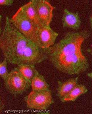 Immunocytochemistry/ Immunofluorescence - Anti-alpha Adaptin antibody [AP6] (AB2730)