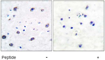 Immunohistochemistry (Formalin/PFA-fixed paraffin-embedded sections) - Anti-alpha Adducin antibody (AB51130)