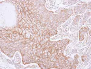 Immunohistochemistry (Formalin/PFA-fixed paraffin-embedded sections) - Anti-alpha Adducin antibody - N-terminal (AB151474)