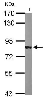 Western blot - Anti-alpha Adducin antibody - N-terminal (AB151474)