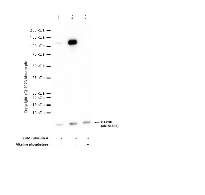 Western blot - Anti-alpha Adducin (phospho S436) antibody [EPR2176] (AB125081)
