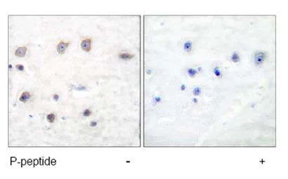 Immunohistochemistry (Formalin/PFA-fixed paraffin-embedded sections) - Anti-alpha Adducin (phospho S726) antibody (AB53093)