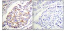 Immunohistochemistry (Formalin/PFA-fixed paraffin-embedded sections) - Anti-alpha Adducin (phospho S726) antibody (AB53093)