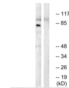 Western blot - Anti-alpha Adducin (phospho S726) antibody (AB53093)