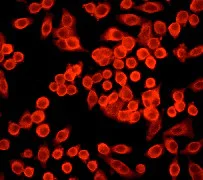 Immunocytochemistry/ Immunofluorescence - Anti-alpha Adducin (phospho S726) antibody [EP734Y] (AB40760)