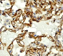 Immunohistochemistry (Formalin/PFA-fixed paraffin-embedded sections) - Anti-alpha Adducin (phospho S726) antibody [EP734Y] (AB40760)