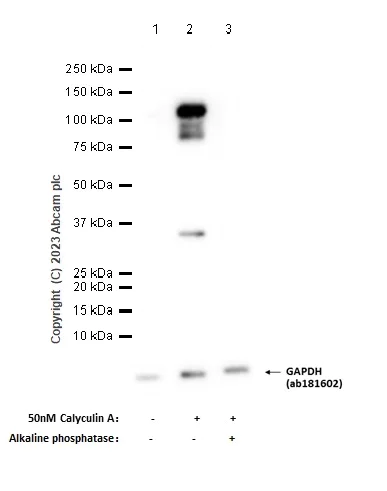 Western blot - Anti-alpha Adducin (phospho S726) antibody [EP734Y] (AB40760)