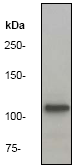 Western blot - Anti-alpha Adducin (phospho S726) antibody [EP734Y] - BSA and Azide free (AB284680), expandable thumbnail