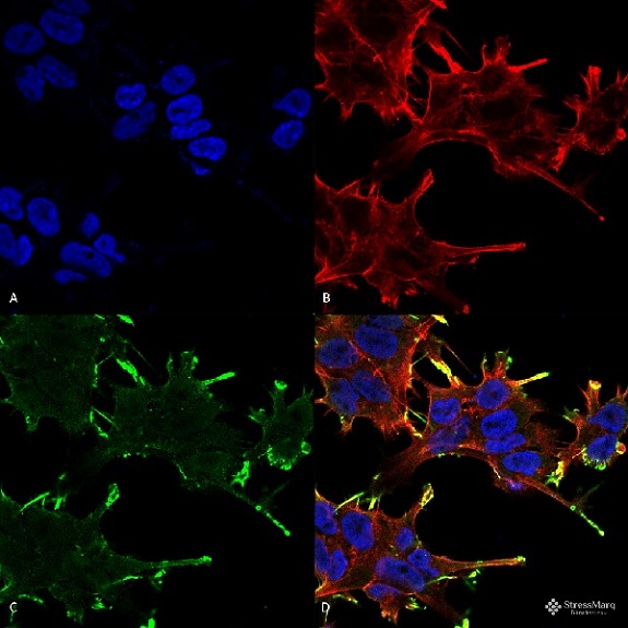 Immunocytochemistry/ Immunofluorescence - Anti-Alpha B Crystallin antibody [1A7.D5] (AB74441), expandable thumbnail