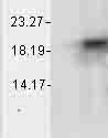 Western blot - Anti-Alpha B Crystallin antibody [1A7.D5] (AB74441), expandable thumbnail