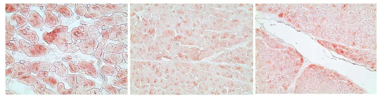 Immunohistochemistry (Formalin/PFA-fixed paraffin-embedded sections) - Anti-Alpha B Crystallin antibody [1B6.1-3G4] (AB13496)