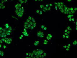 Immunocytochemistry/ Immunofluorescence - Anti-Alpha B Crystallin antibody [6D11] (AB230722)