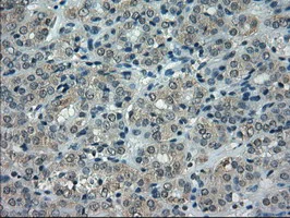 Immunohistochemistry (Formalin/PFA-fixed paraffin-embedded sections) - Anti-Alpha B Crystallin antibody [6D11] (AB230722)