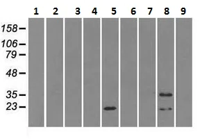 Western blot - Anti-Alpha B Crystallin antibody [6D11] (AB230722)