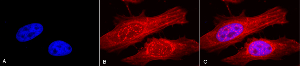 Immunocytochemistry/ Immunofluorescence - Anti-Alpha B Crystallin antibody (AB13497)