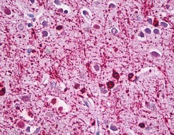 Immunohistochemistry (Formalin/PFA-fixed paraffin-embedded sections) - Anti-Alpha B Crystallin antibody (AB166839), expandable thumbnail
