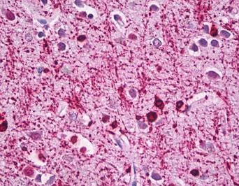 Immunohistochemistry (Formalin/PFA-fixed paraffin-embedded sections) - Anti-Alpha B Crystallin antibody (AB166839)