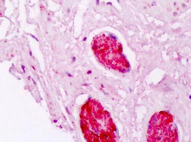 Immunohistochemistry (Formalin/PFA-fixed paraffin-embedded sections) - Anti-Alpha B Crystallin antibody (AB166839)