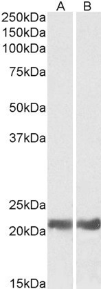 Western blot - Anti-Alpha B Crystallin antibody (AB65940), expandable thumbnail