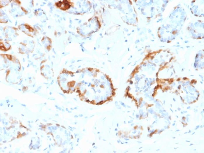 Immunohistochemistry (Formalin/PFA-fixed paraffin-embedded sections) - Anti-Alpha B Crystallin antibody [CPTC-CRYAB-1] (AB268037), expandable thumbnail