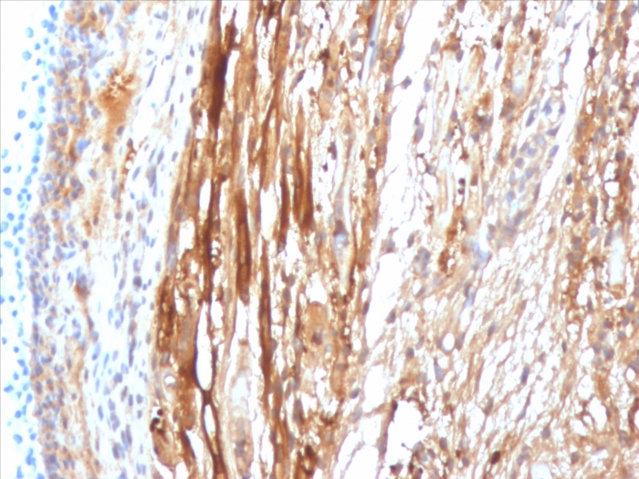 Immunohistochemistry (Formalin/PFA-fixed paraffin-embedded sections) - Anti-Alpha B Crystallin antibody [CPTC-CRYAB-1] (AB268037), expandable thumbnail