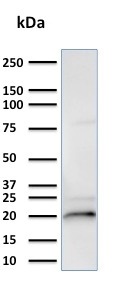 Western blot - Anti-Alpha B Crystallin antibody [CPTC-CRYAB-1] (AB268037), expandable thumbnail