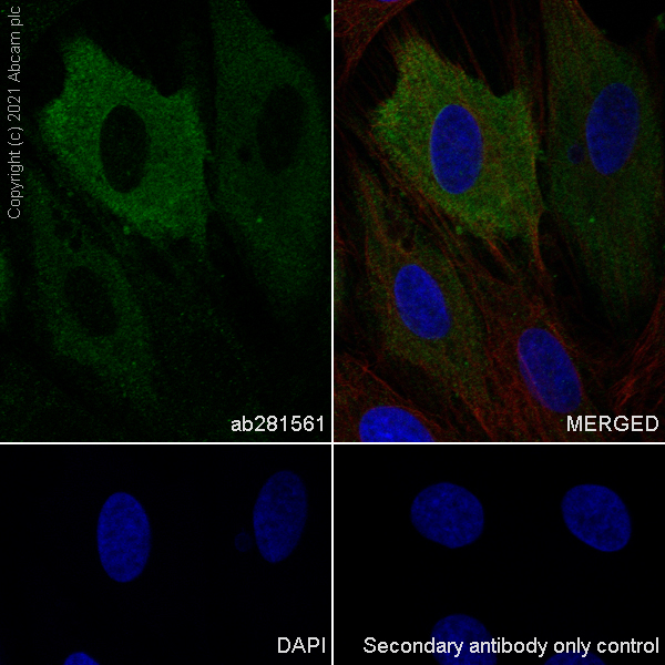 Immunocytochemistry/ Immunofluorescence - Anti-Alpha B Crystallin antibody [EPR24521-60] (ab281561), expandable thumbnail