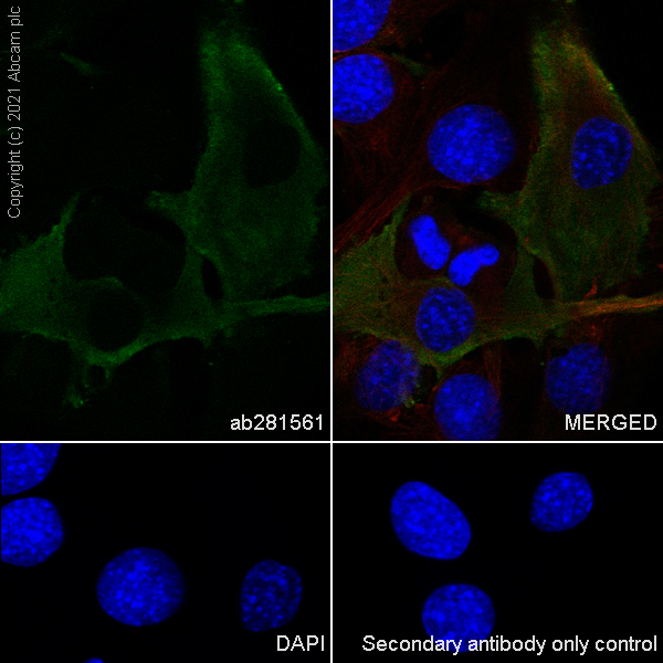 Immunocytochemistry/ Immunofluorescence - Anti-Alpha B Crystallin antibody [EPR24521-60] (ab281561), expandable thumbnail