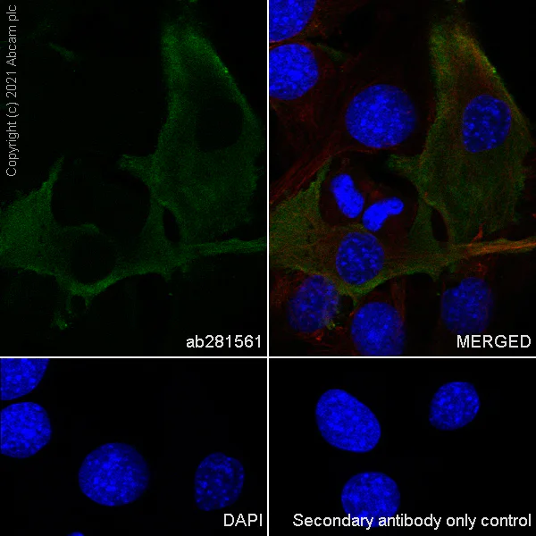 Immunocytochemistry/ Immunofluorescence - Anti-Alpha B Crystallin antibody [EPR24521-60] (AB281561)