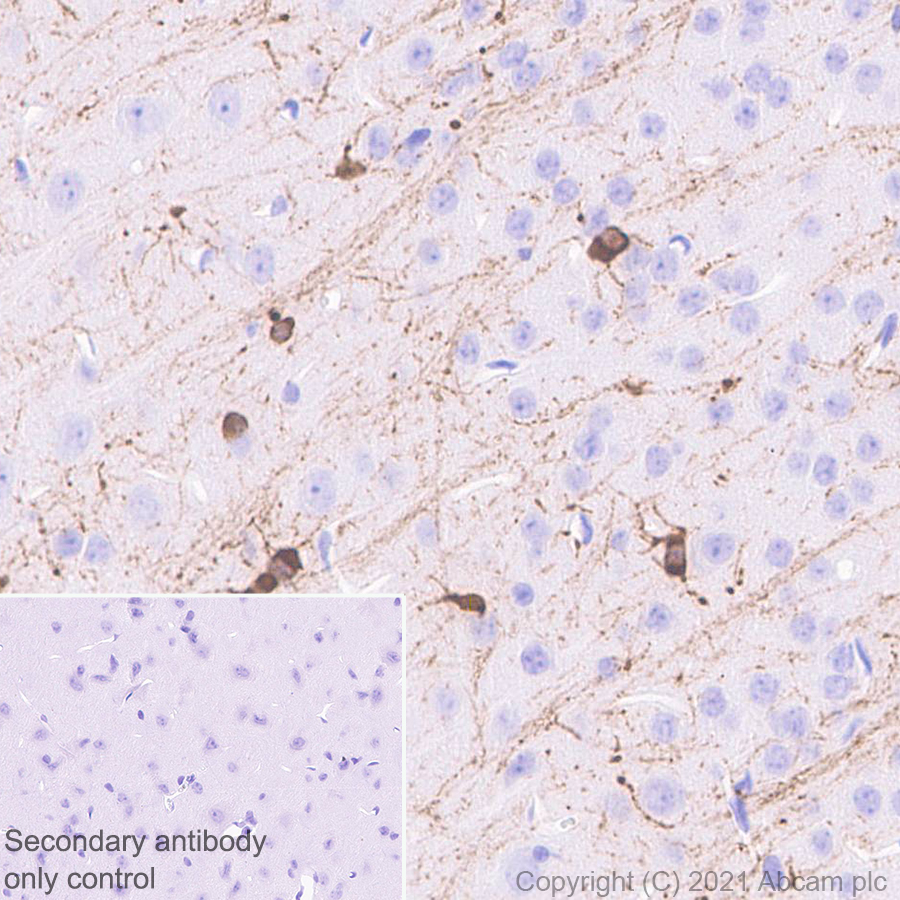 Immunohistochemistry (Formalin/PFA-fixed paraffin-embedded sections) - Anti-Alpha B Crystallin antibody [EPR24521-60] (AB281561), expandable thumbnail