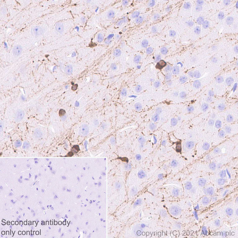 Immunohistochemistry (Formalin/PFA-fixed paraffin-embedded sections) - Anti-Alpha B Crystallin antibody [EPR24521-60] - BSA and Azide free (AB281569)