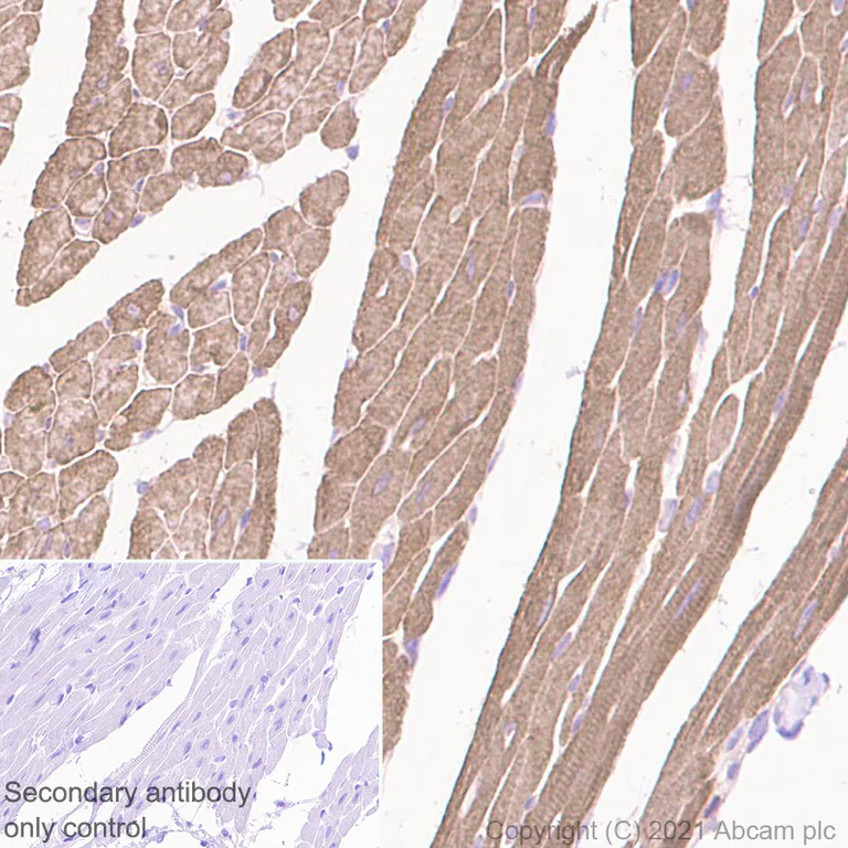 Immunohistochemistry (Formalin/PFA-fixed paraffin-embedded sections) - Anti-Alpha B Crystallin antibody [EPR24521-60] - BSA and Azide free (AB281569)