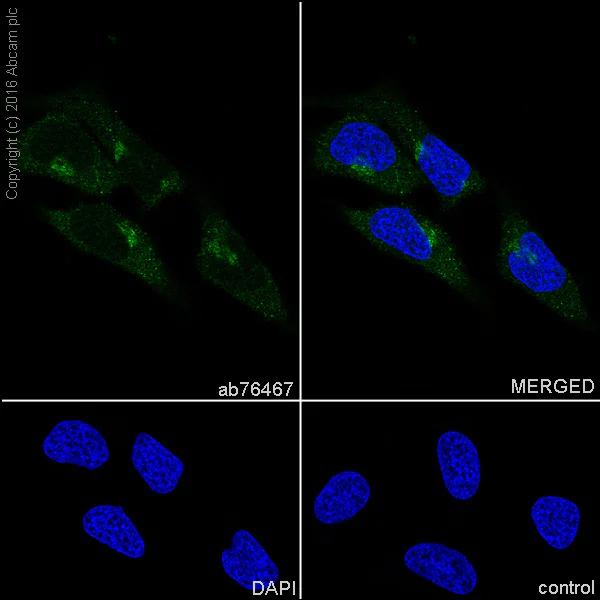 Immunocytochemistry/ Immunofluorescence - Anti-Alpha B Crystallin antibody [EPR2752] (AB76467)