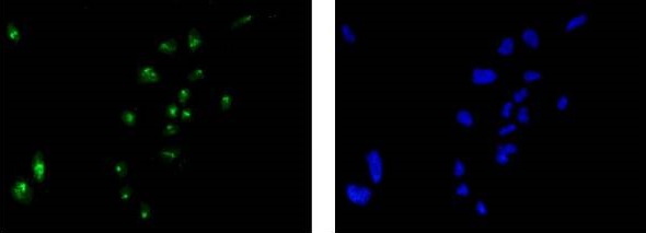 Immunocytochemistry/ Immunofluorescence - Anti-Alpha B Crystallin antibody [EPR2752] (ab76467), expandable thumbnail