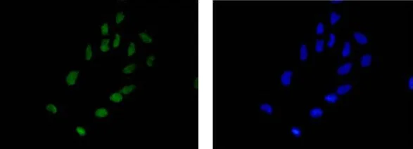 Immunocytochemistry/ Immunofluorescence - Anti-Alpha B Crystallin antibody [EPR2752] (AB76467)