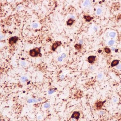 Immunohistochemistry (Formalin/PFA-fixed paraffin-embedded sections) - Anti-Alpha B Crystallin antibody [EPR2752] (AB76467), expandable thumbnail