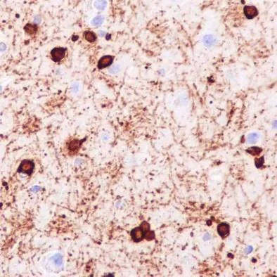 Immunohistochemistry (Formalin/PFA-fixed paraffin-embedded sections) - Anti-Alpha B Crystallin antibody [EPR2752] (AB76467)