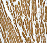 Immunohistochemistry (Formalin/PFA-fixed paraffin-embedded sections) - Anti-Alpha B Crystallin antibody [EPR2752] (ab76467), expandable thumbnail