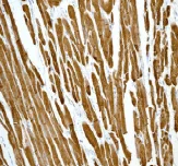 Immunohistochemistry (Formalin/PFA-fixed paraffin-embedded sections) - Anti-Alpha B Crystallin antibody [EPR2752] (AB76467)