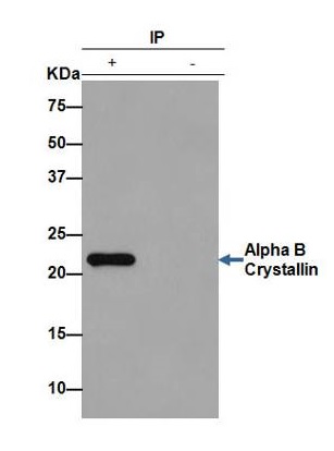 Immunoprecipitation - Anti-Alpha B Crystallin antibody [EPR2752] (ab76467), expandable thumbnail