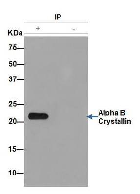 Western blot - Anti-Alpha B Crystallin antibody [EPR2752] (ab76467), expandable thumbnail