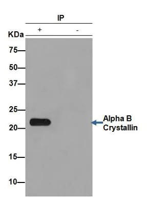 Western blot - Anti-Alpha B Crystallin antibody [EPR2752] (AB76467)