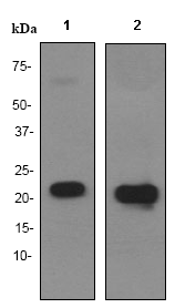 Western blot - Anti-Alpha B Crystallin antibody [EPR2752] (ab76467), expandable thumbnail