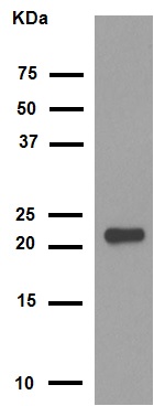 Western blot - Anti-Alpha B Crystallin antibody [EPR2752] (AB76467), expandable thumbnail