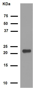 Western blot - Anti-Alpha B Crystallin antibody [EPR2752] (AB76467)