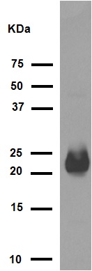 Western blot - Anti-Alpha B Crystallin antibody [EPR2752] (AB76467), expandable thumbnail